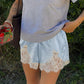 🌿🔥LIMITED TIME 50% OFF!🔥50K+ SOLD! ✨Satin Lace Trim Shorts
