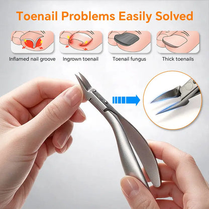 🦶 50% OFF! 🔧 2-Piece Toenail Set – Ingrown clipper & dead skin nipper ✨